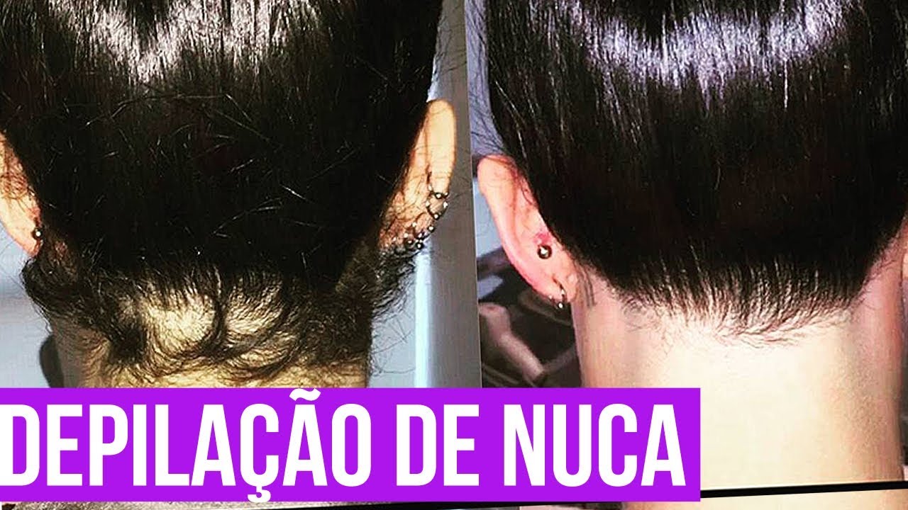 Depilação de Nuca