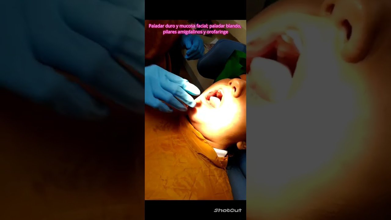 Exploración Oral/patología bucal