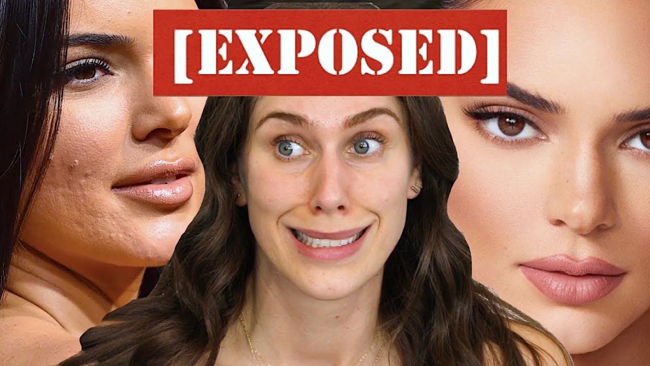 So today I decided to wake up and expose  celebrity acne & photoshop