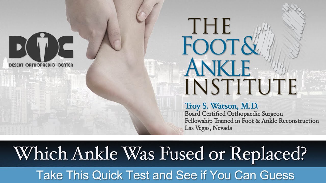 Video Marketing for Orthopedic Surgeons