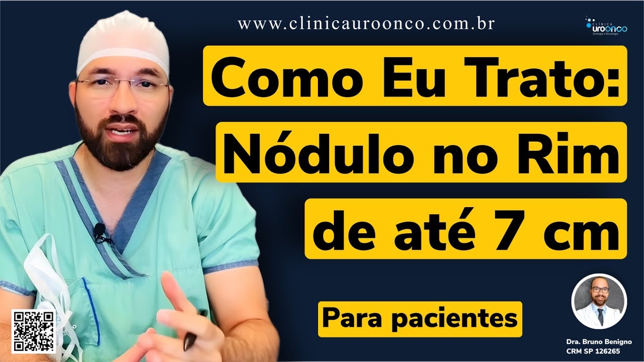 Como Eu Trato: N&oacute;dulos no Rim de at&eacute; 7 cm. Guia para pacientes e familiares
