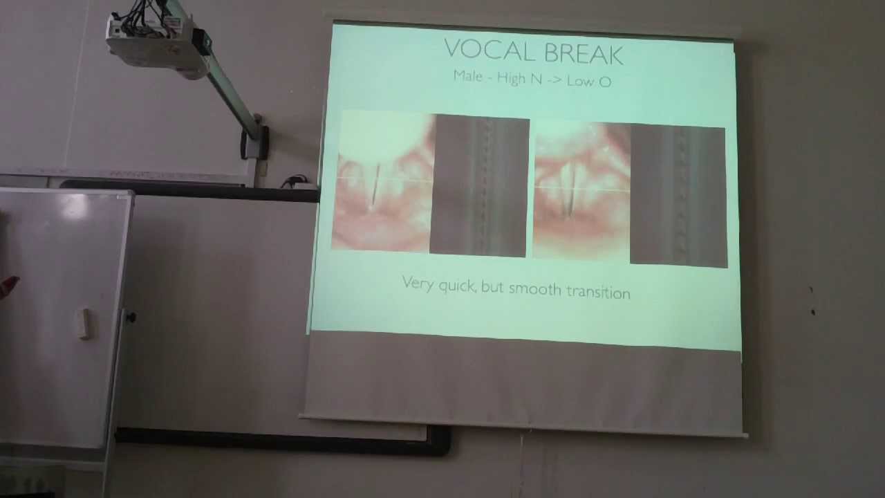 Videokymographic study of the Vocal Folds in the Vocal Modes, Flageolet & Vocal Effects of CVT