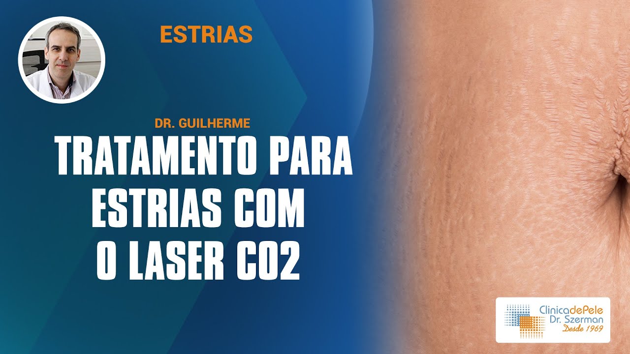 Estrias [Tratamento com Laser de CO2]