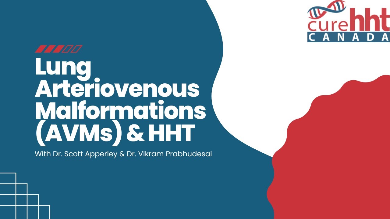 Lung Arteriovenous Malformations (AVMs) and Hereditary Hemorrhagic Telangiectasia (HHT)
