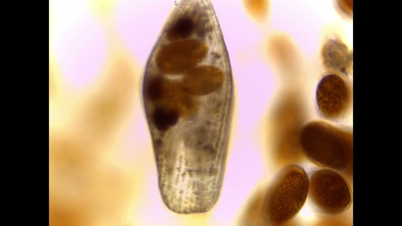 Dinoflagelados (Ostreopsis ovata) y paramecium (ciliados) , vistos en microscopio profesional.