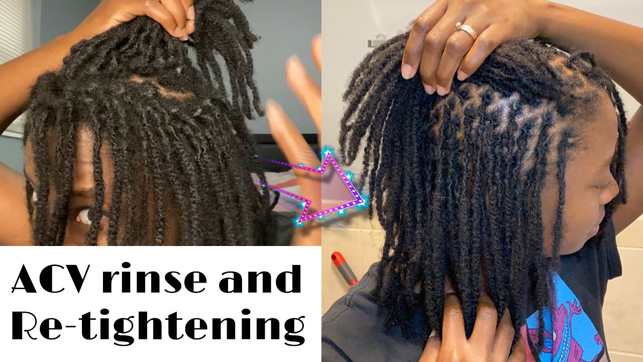 ACV rinse loc maintenance *1 year locd