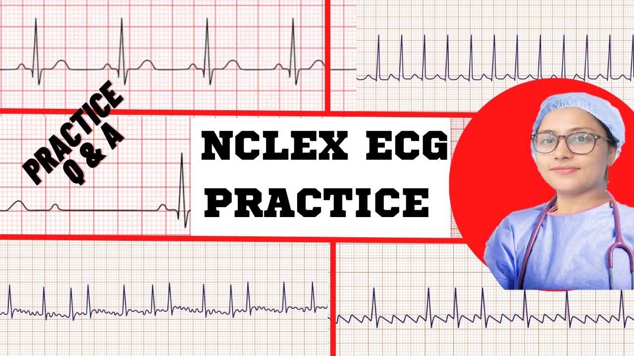 ЭКГ NCLEX ВОПРОСЫ И ОТВЕТЫ ПРАКТИКА I NCLEX RN ПРАКТИКА И ОТВЕТЫ ПО ЭКГ / ЭКГ