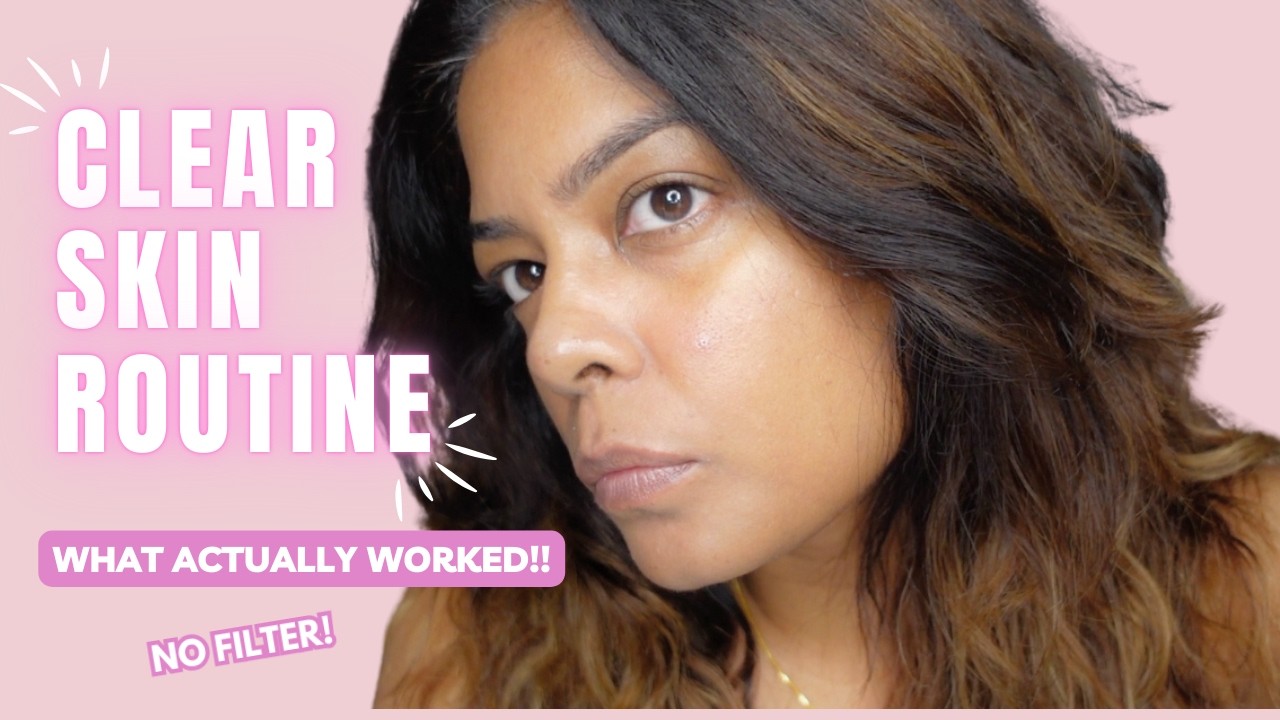 How I Finally Got Clear Skin | Real Skincare Routine + Honest Reviews