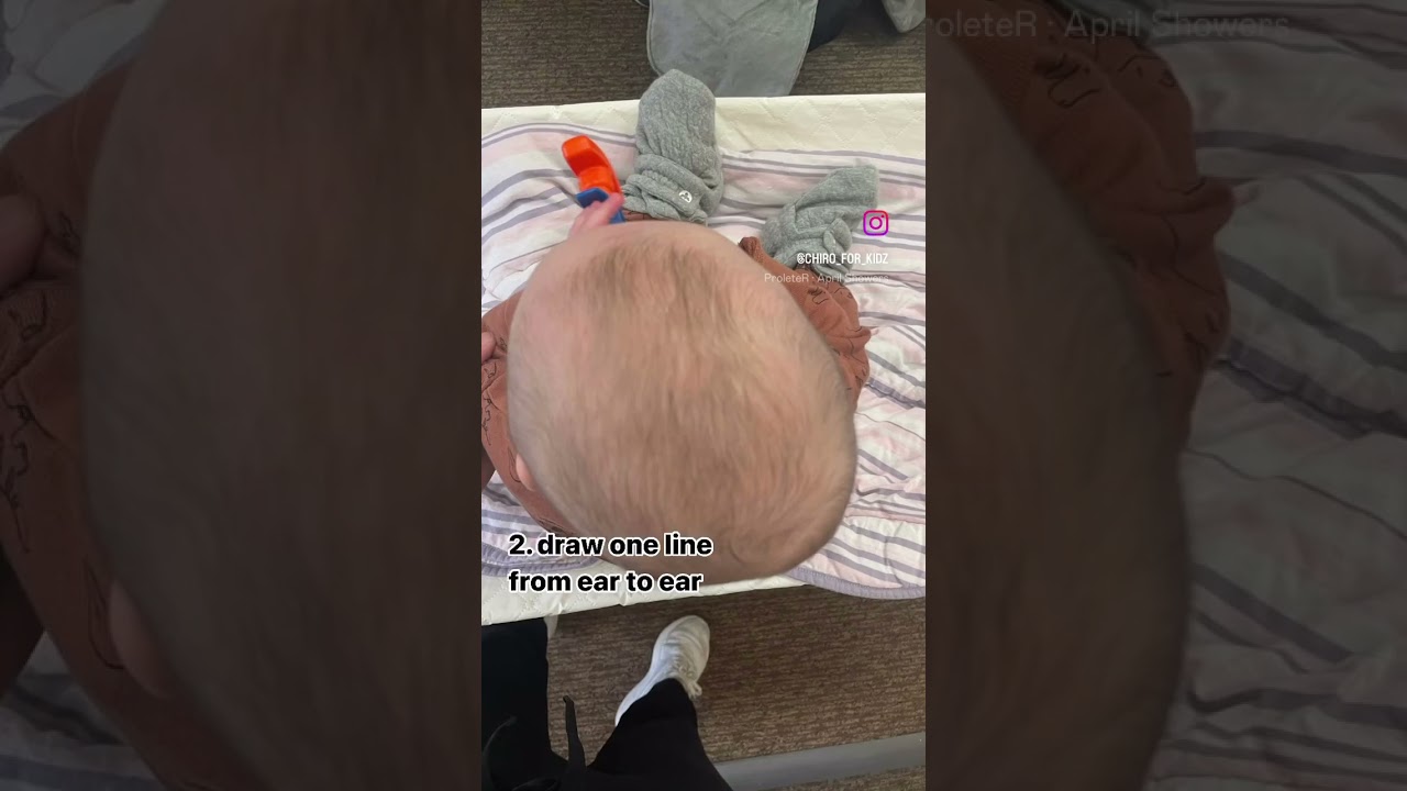 How to Check Your Baby&rsquo;s Head for a Flat Spot! #babyshorts #torticollis #plagiocephaly #helmet