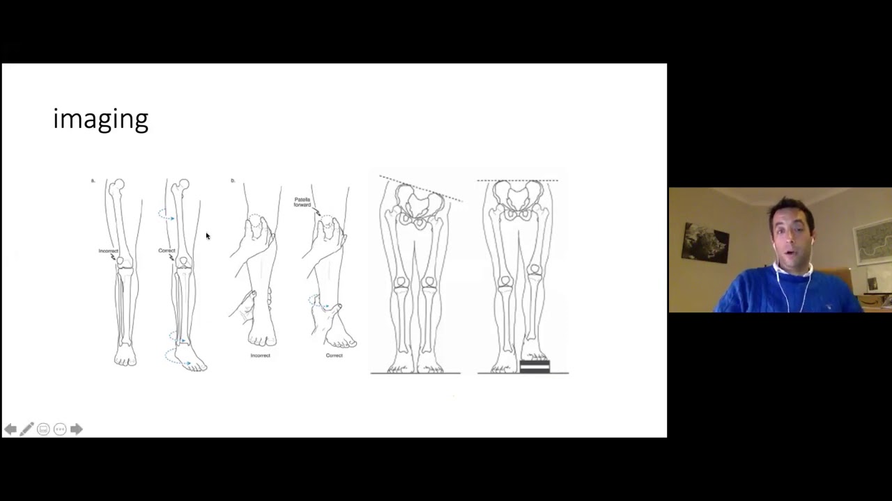 Principles of deformity correction for the FRCS