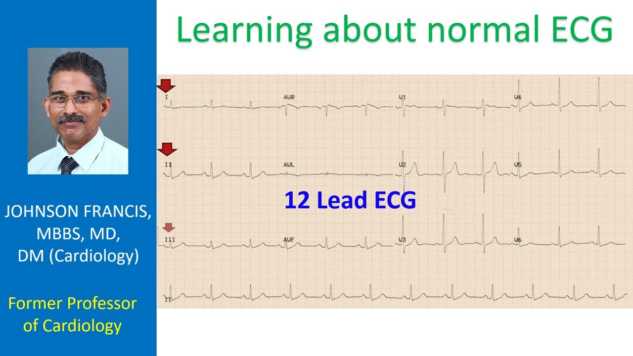 Learning about normal ECG
