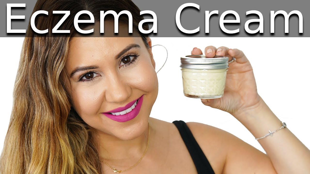 DIY Eczema Cream - Itchy Skin Relief