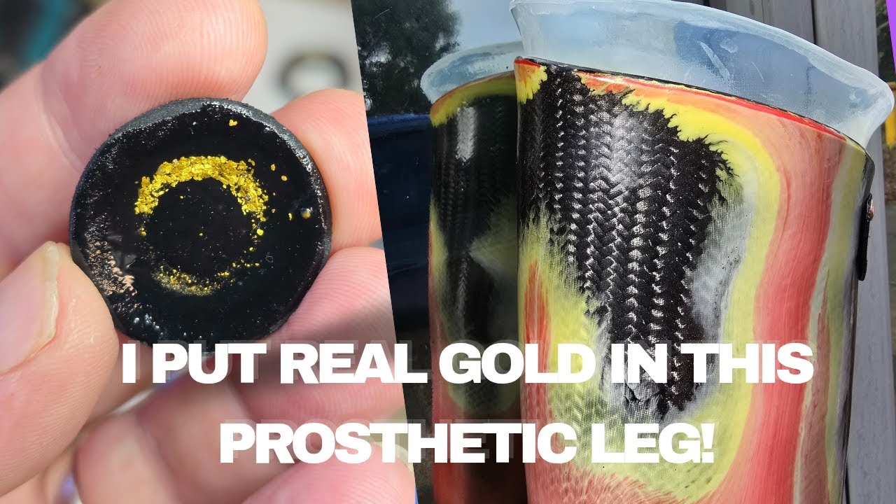 Prosthetic 'Lava' Socket with Real Gold!