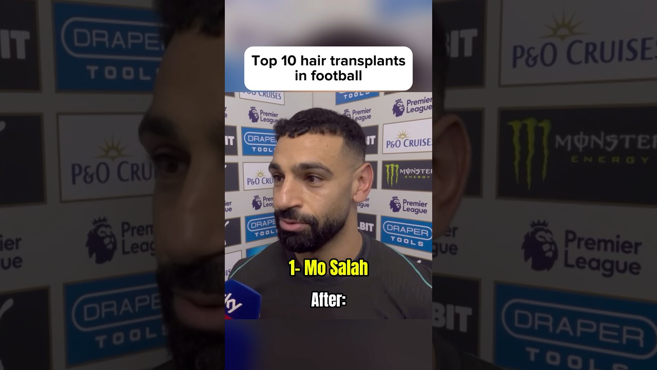 Top 10 Hair Transplants in Football