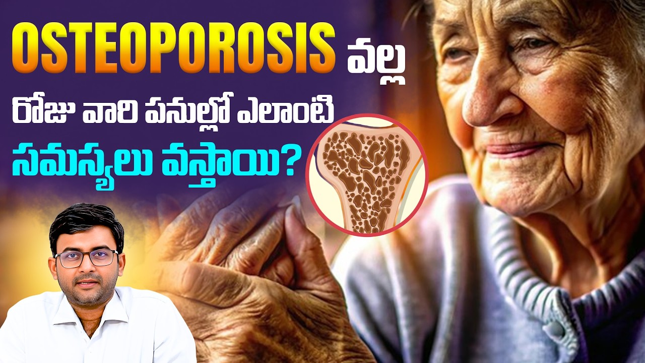 Osteoporosis వల్ల వచ్చే సమస్యలు ఏంటి? | Wrists fracture | Hip fracture | Osteoporosis | Back pain