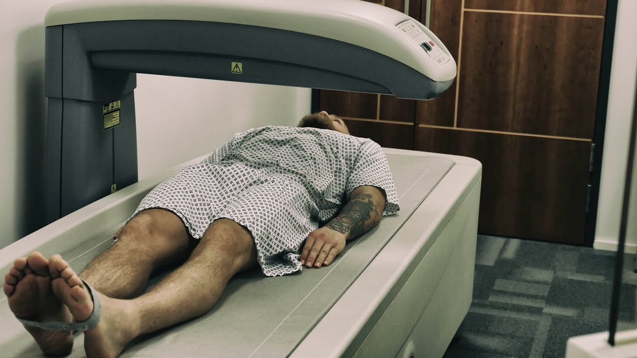 Conor McGregor undergoes a DEXA scan: The Mac Life DAY 2
