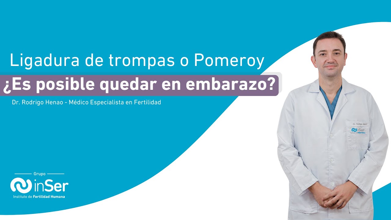 Ligadura de trompas o Pomeroy ¿Es posible quedar en embarazo?