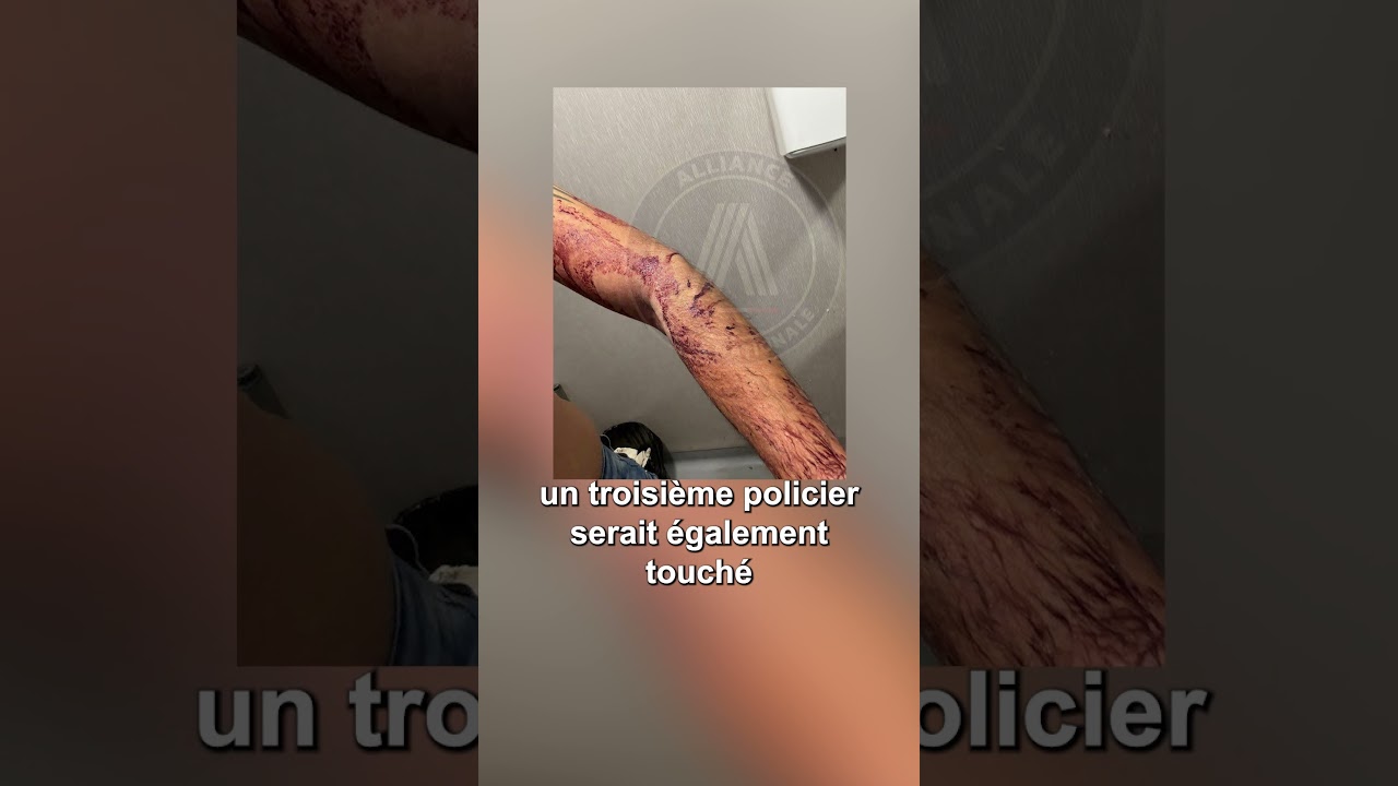 Des policiers agress&eacute;s &agrave; Paris dans le 17e arrondissement