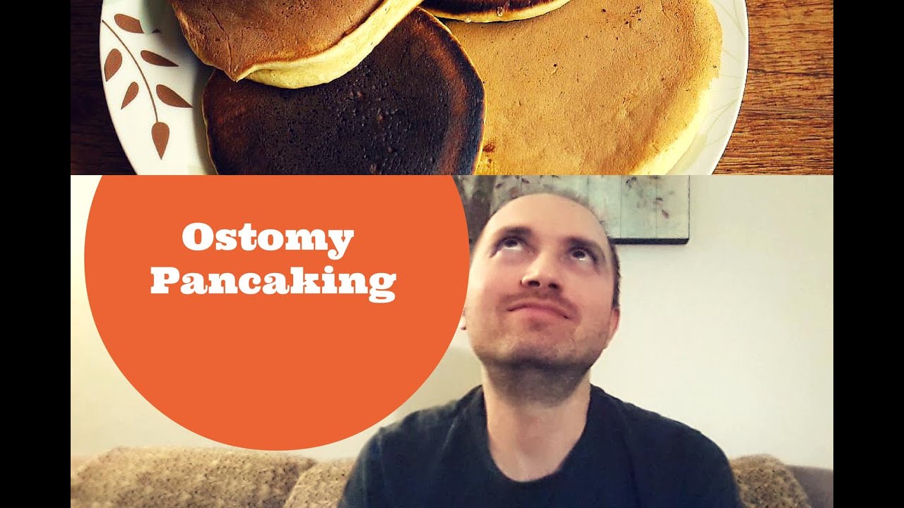Ostomy Care Tips: Dealing with Pancaking
