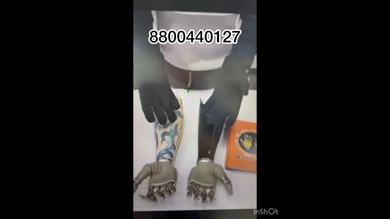 For free myo testing with bionic hand#contact us#08800440127 #best center#artificialhand #bionic