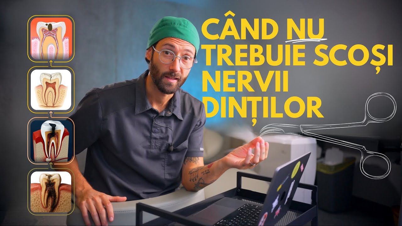 Cand NU TREBUIE SCOSI NERVII DINTILOR (si cand trebuie)