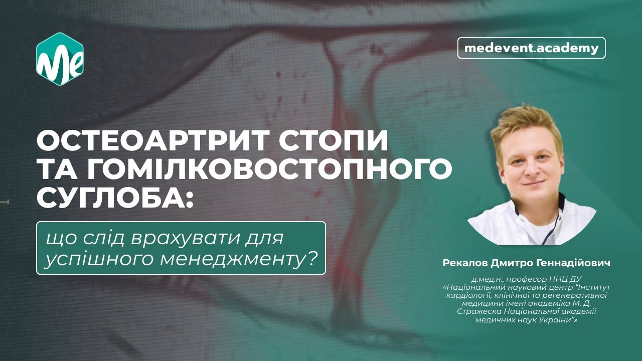 Остеоартрит стопи та гомілковостопного суглоба: що слід врахувати для успішного менеджменту?