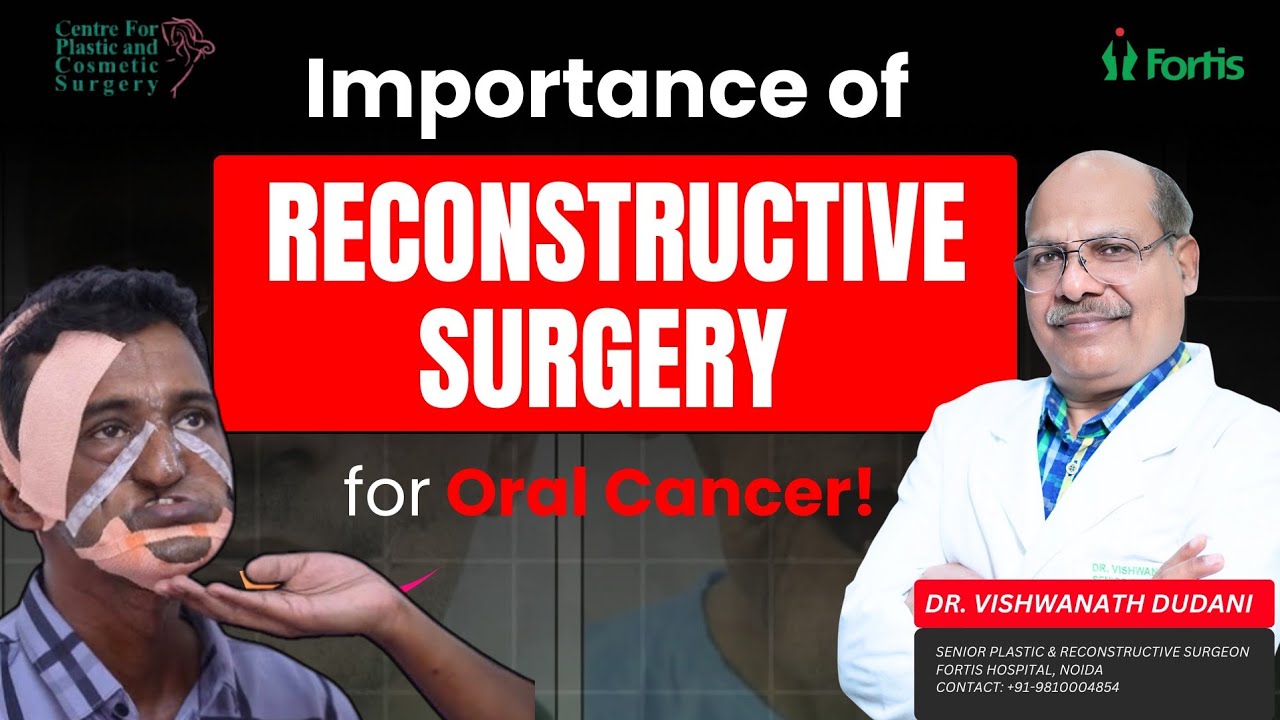 मुंह के कैंसर के बाद Reconstruction कैसे होती है? |Oral Cancer Reconstruction| Dr. Vishwanath Dudani