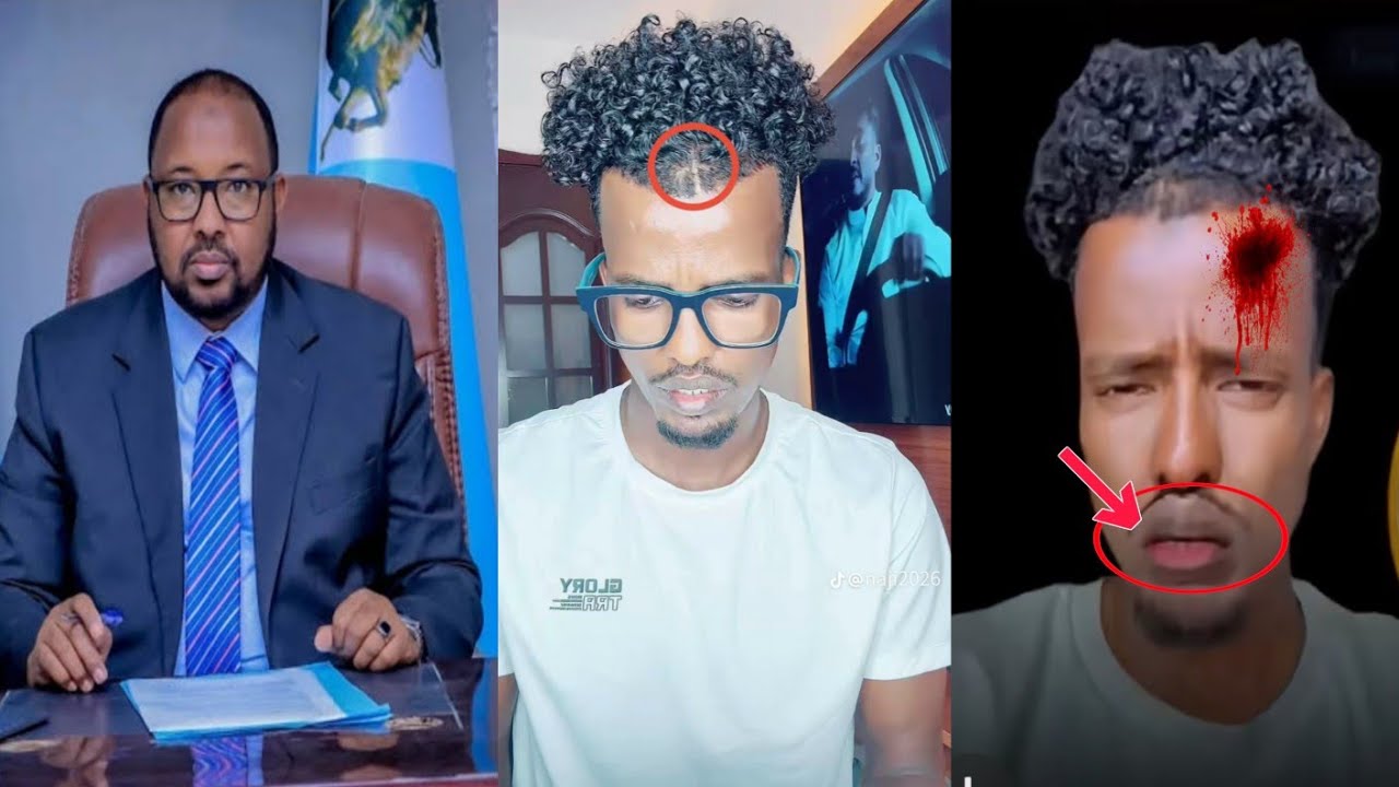 NAXDIN DAAWO MAXA KA OGTAHAY WAXA KUDHACAY WIILKI DHULBAHANTE EE CAANKA AHA GOAT GEESEY 