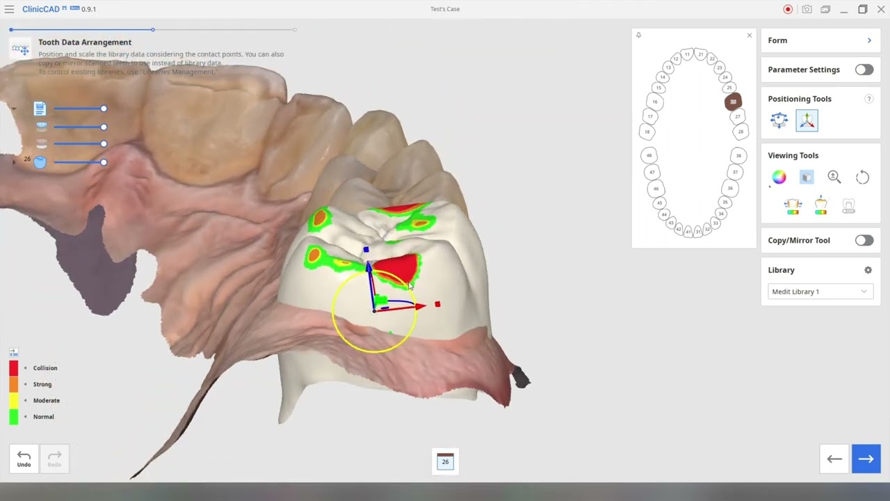 Medit ClinicCAD single crown design brief walkthrough