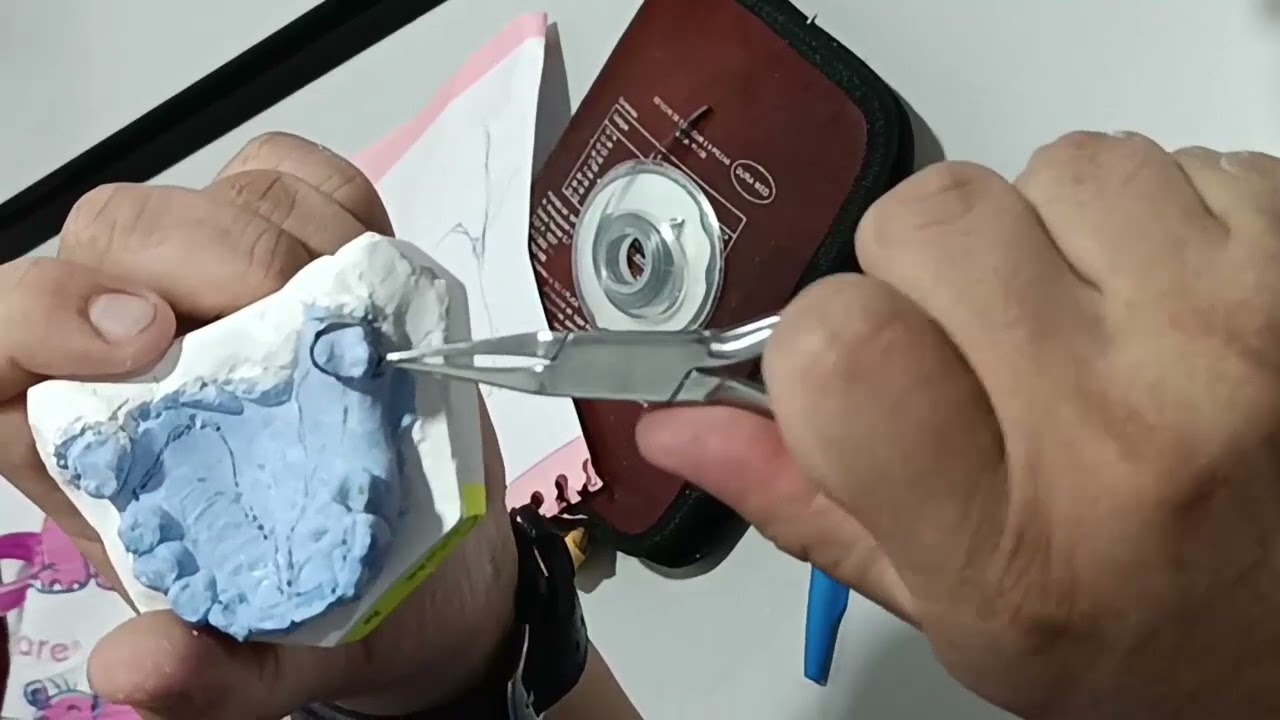 Mantenedor de Espacio Banda y Ansa (Dr. Cesar Cortez Sosa)