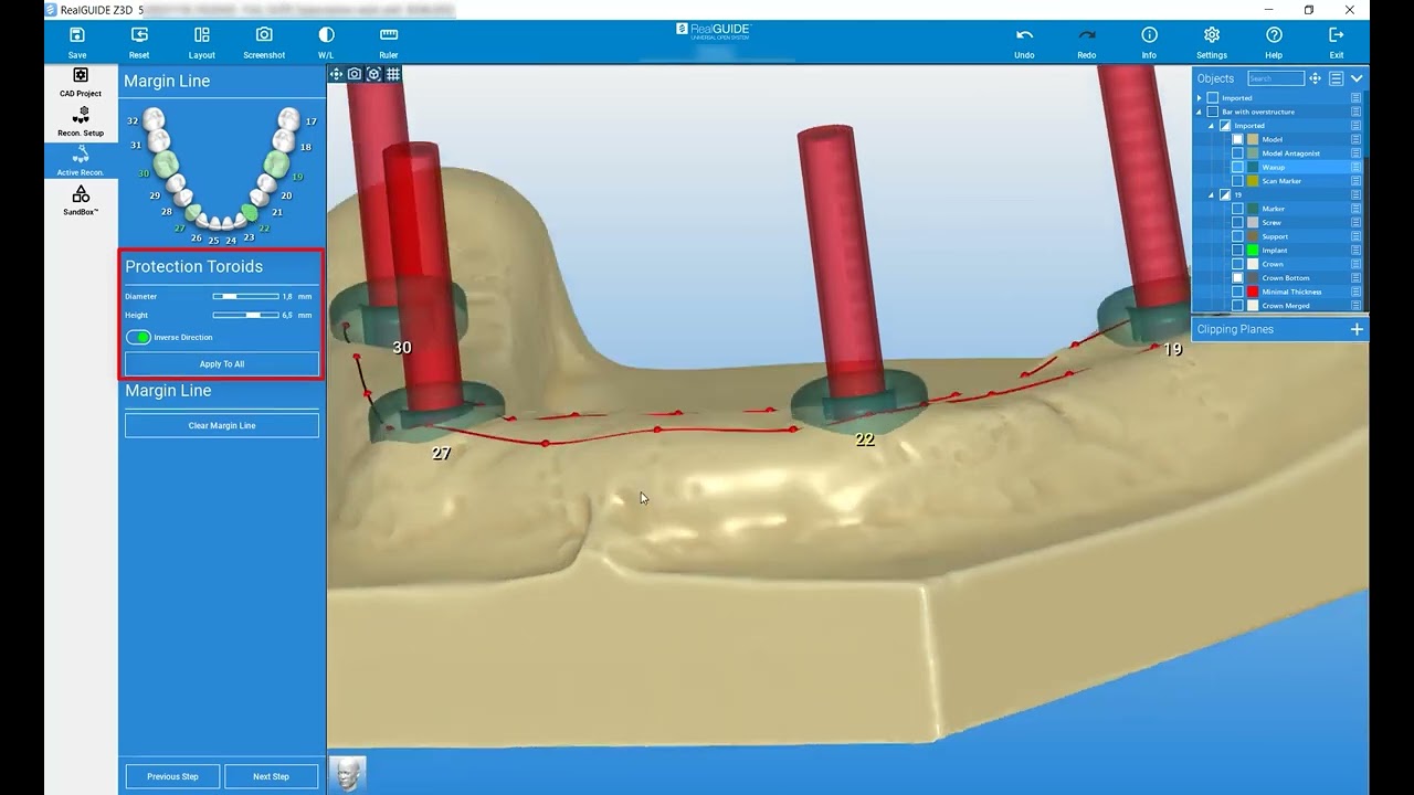 RealGUIDE Software:  Reconstruction Setup- Part 2