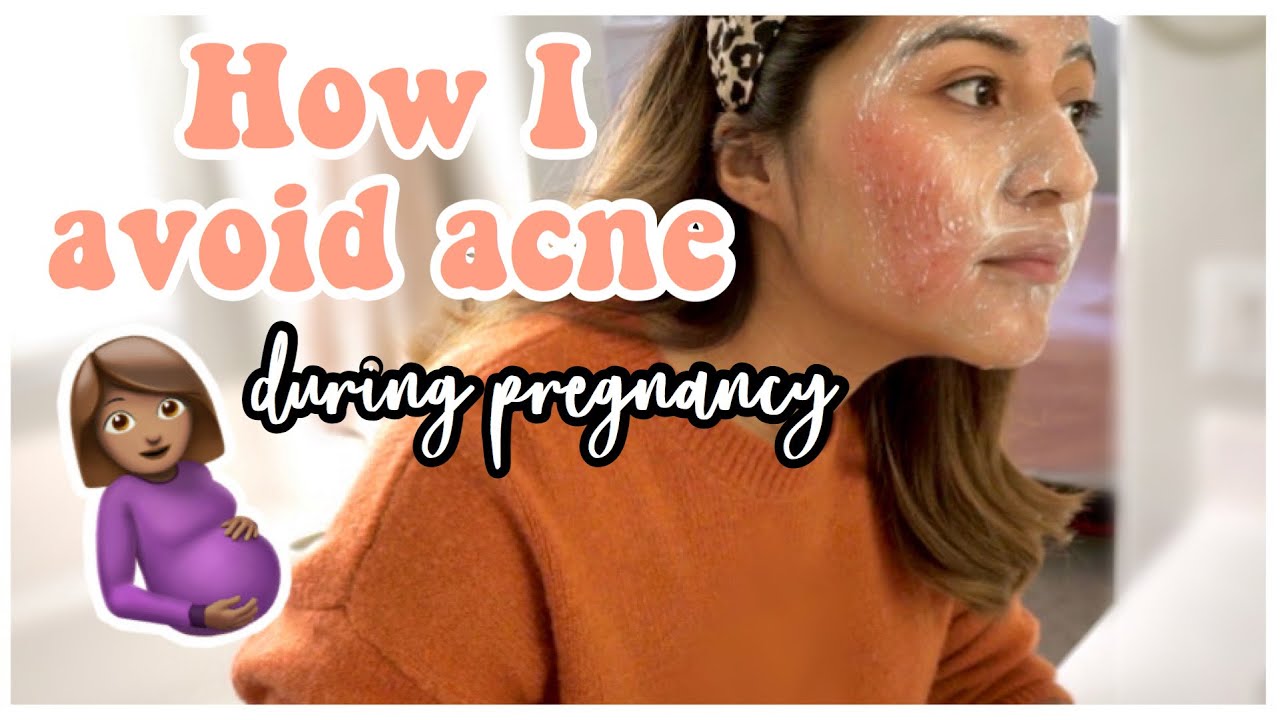 My PREGNANT Skin Care Routine 💆🏽&zwj;♀️✨| How I Avoid Getting Acne & Stretch Marks