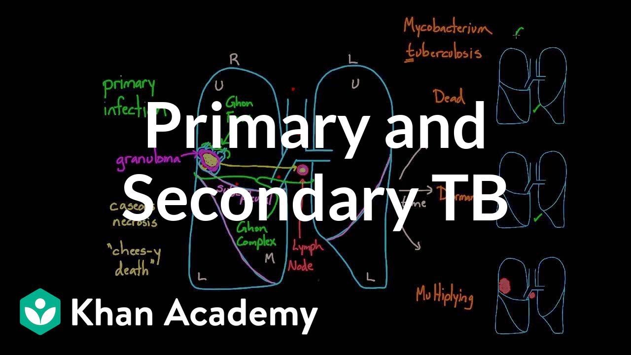 Primary and Secondary TB | Infectious diseases | NCLEX-RN | Khan Academy