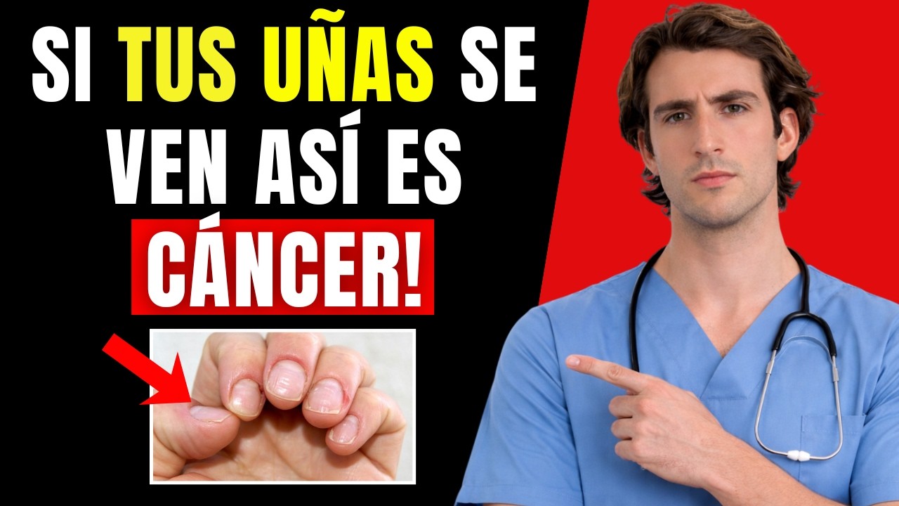 Adultos mayores: Si sus uñas se ven así, es un signo oculto de cáncer (explica un médico).