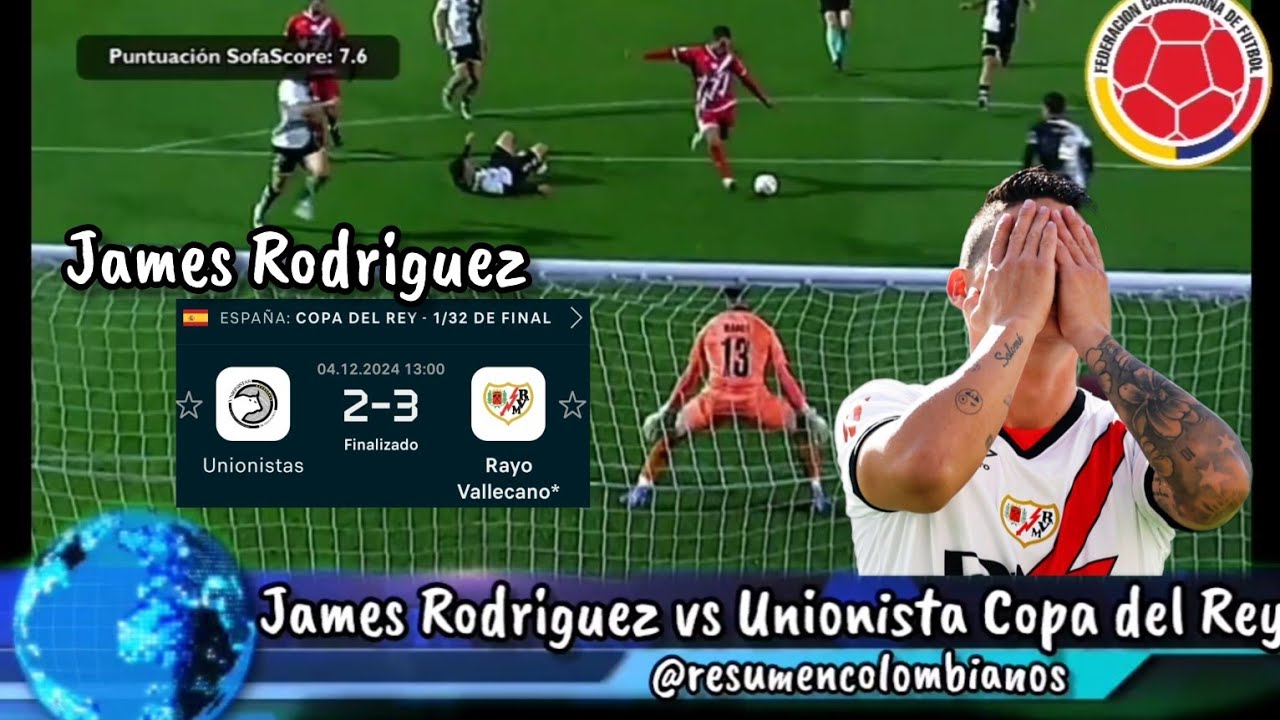 James Rodriguez vs Unionista por la copa del Rey 🤴