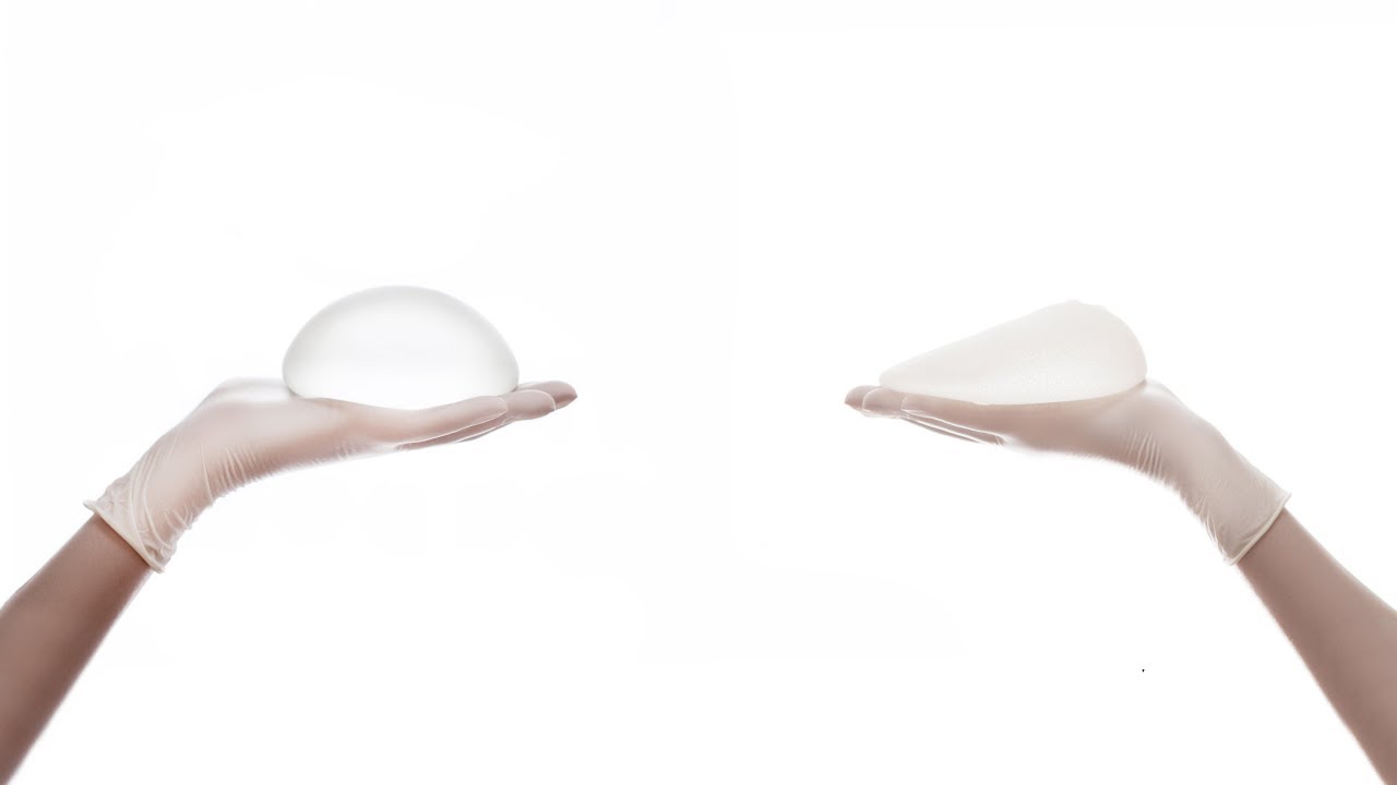 Breast Augmentation Part 2: Breast Implants—Is Bigger Better? | Dream Aesthetics and Plastic Surgery