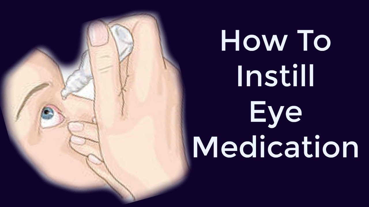 How to instill eye drops | RN Krizzy