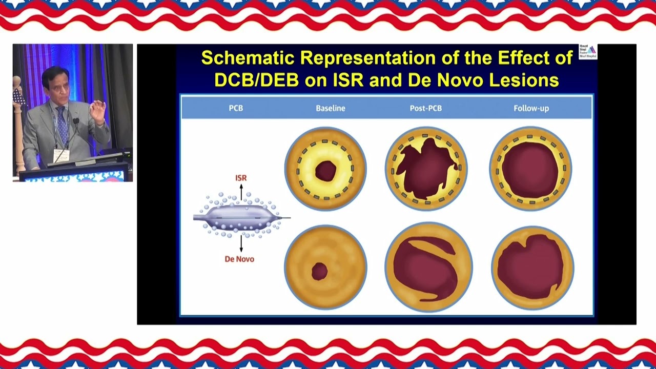 Samin K  Sharma, MD   Top Ten Advances of Interventional Cardiology 2023 – 2024