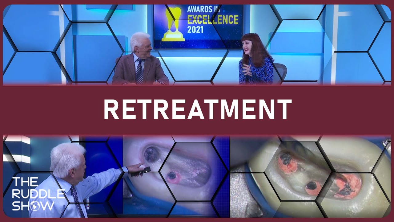 S06 E08 - Nonsurgical Retreatment: Carrier-Based Obturation Removal & MTA vs. Calcium Hydroxide