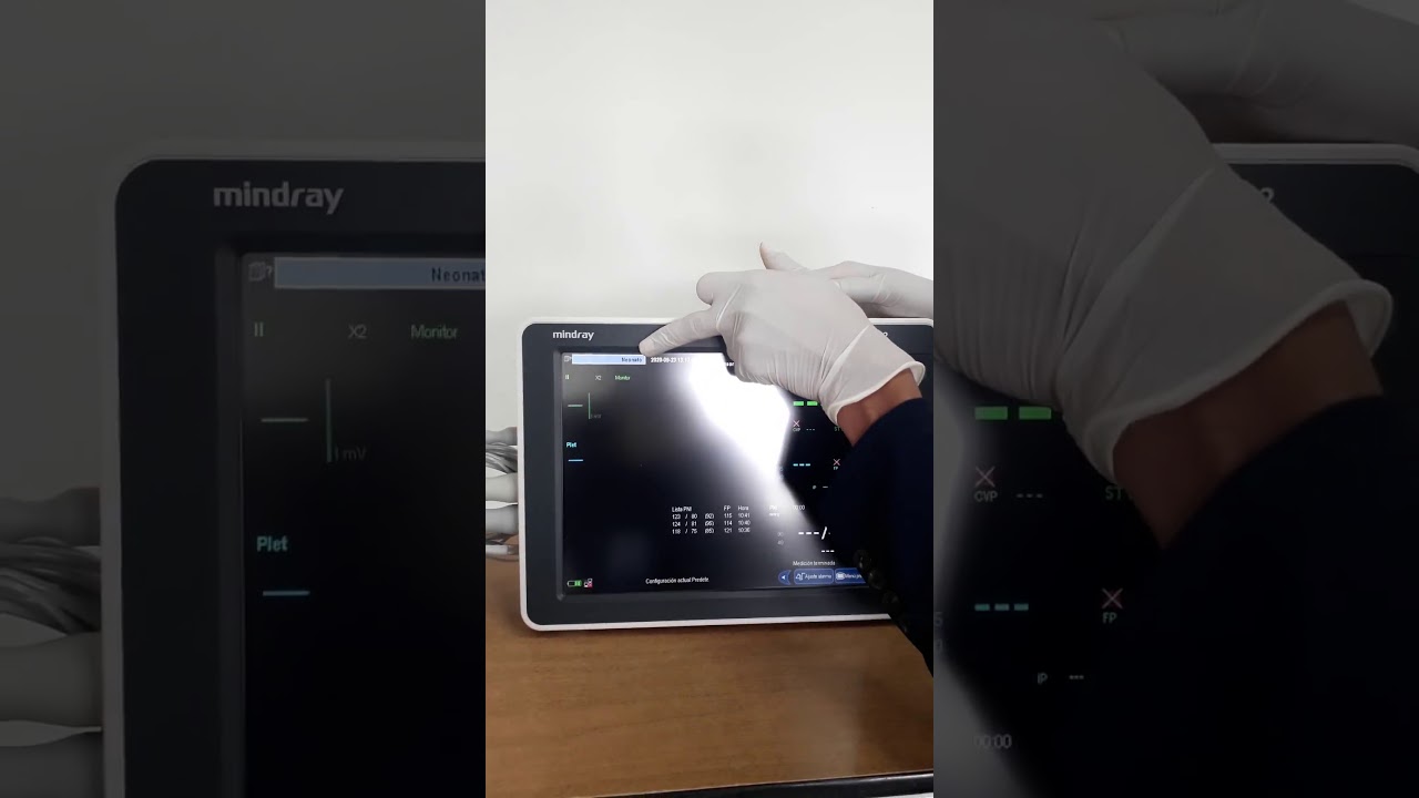 Monitor Mindary uMEC12, Parte 1