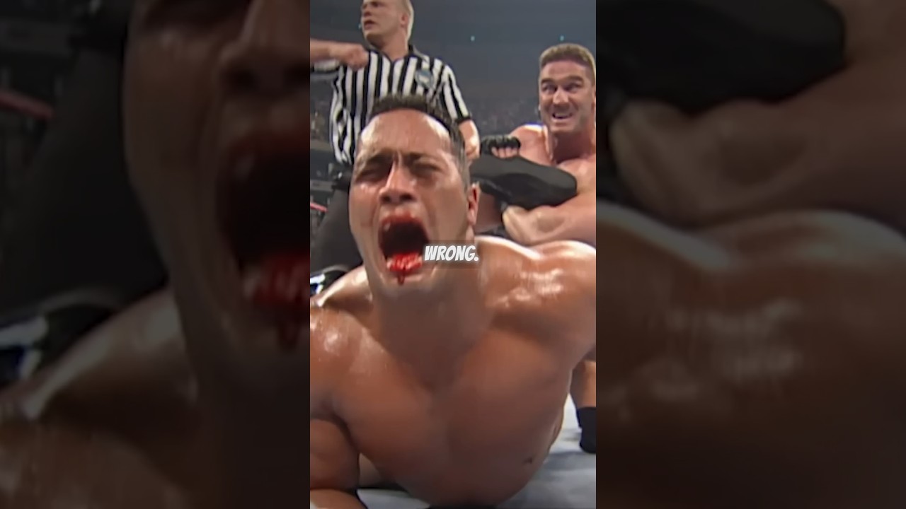The Rock&rsquo;s Career Nearly Ended Because of This Injury!