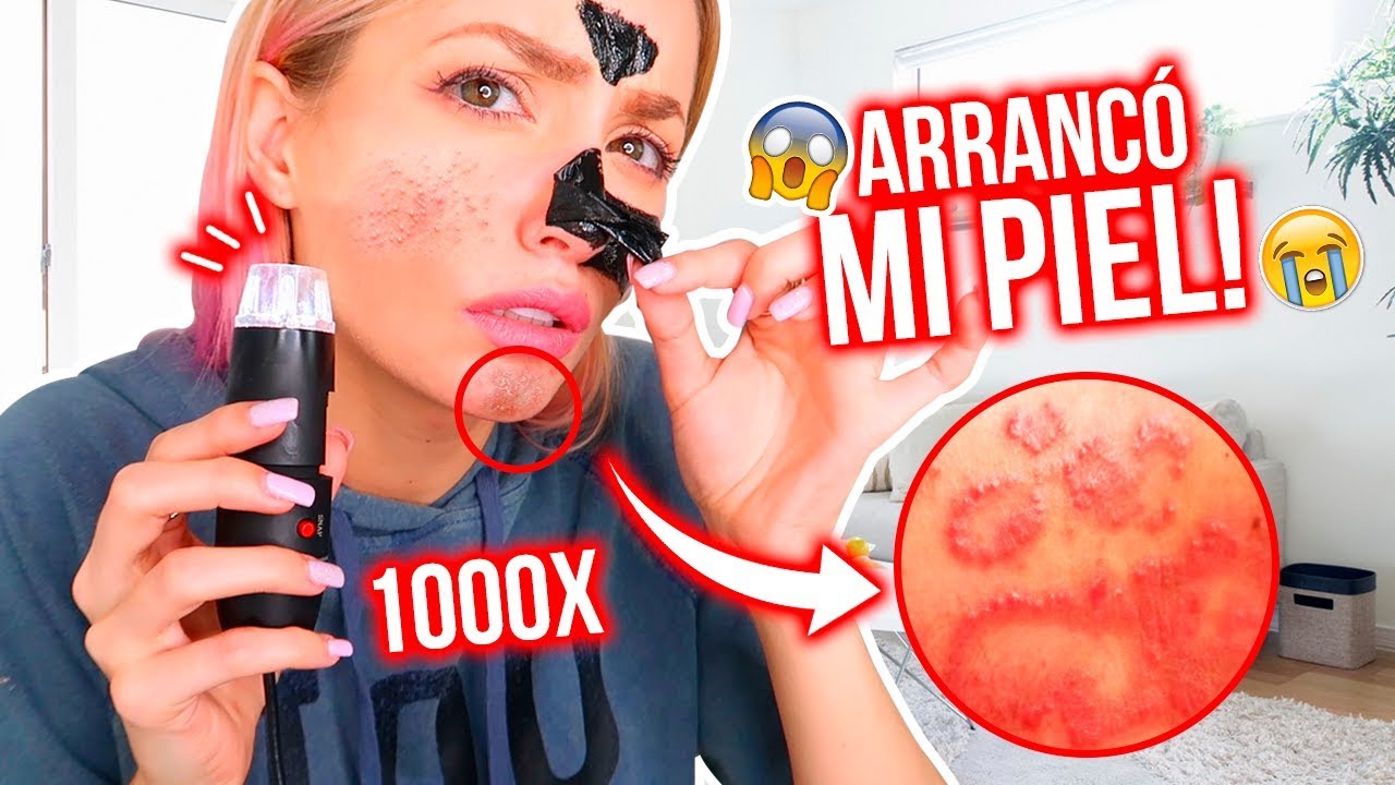 MASCARILLA NEGRA PEEL OFF al MICROSCOPIO! ARRANCÓ MI PIEL!!!😱😫 | Katie Angel