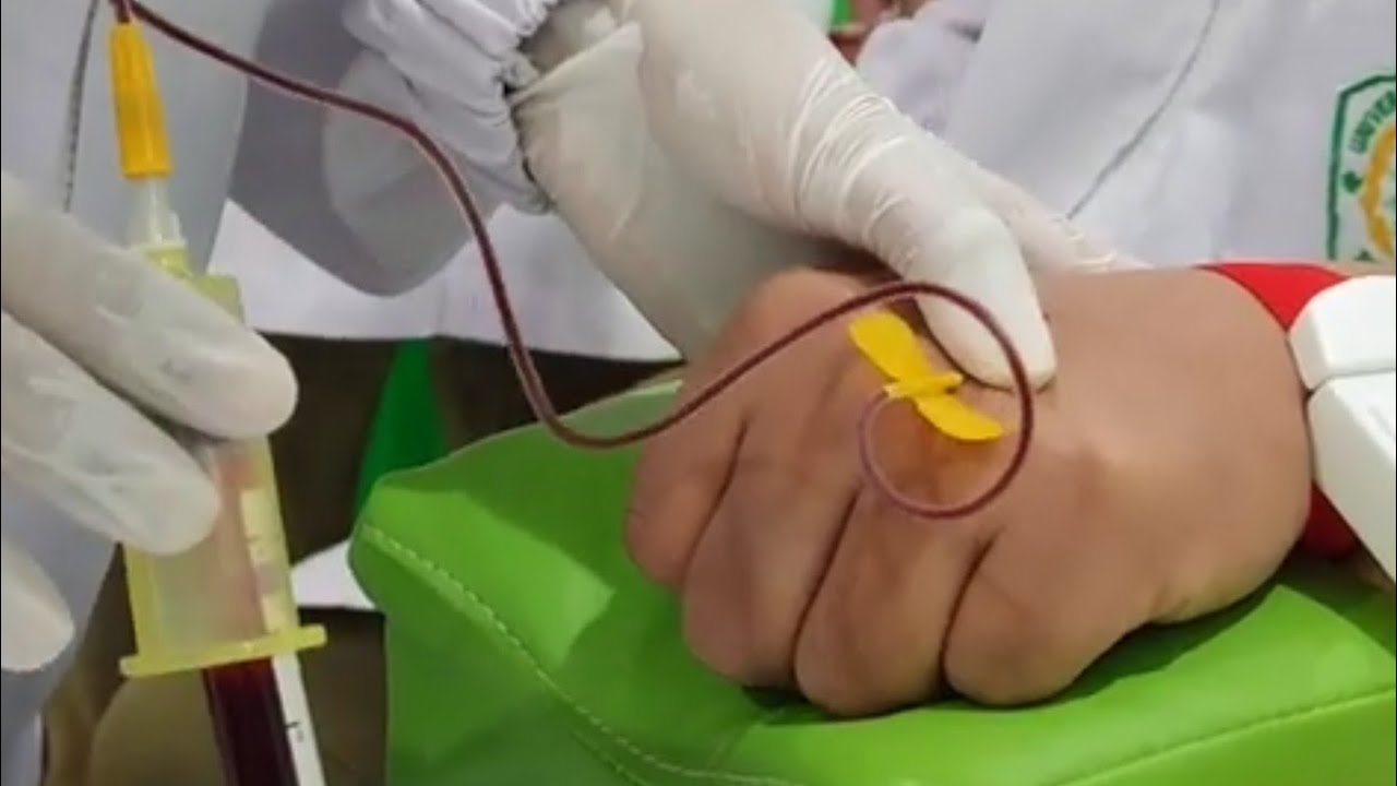 TEKNIK SAMPLING MENGGUNAKAN WING NEEDLE
