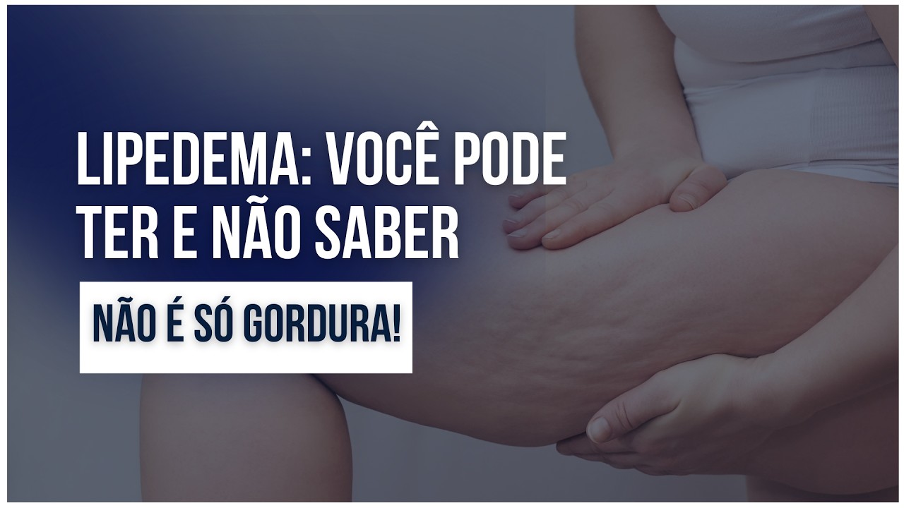 Entenda a diferença entre Lipedema e Linfedema