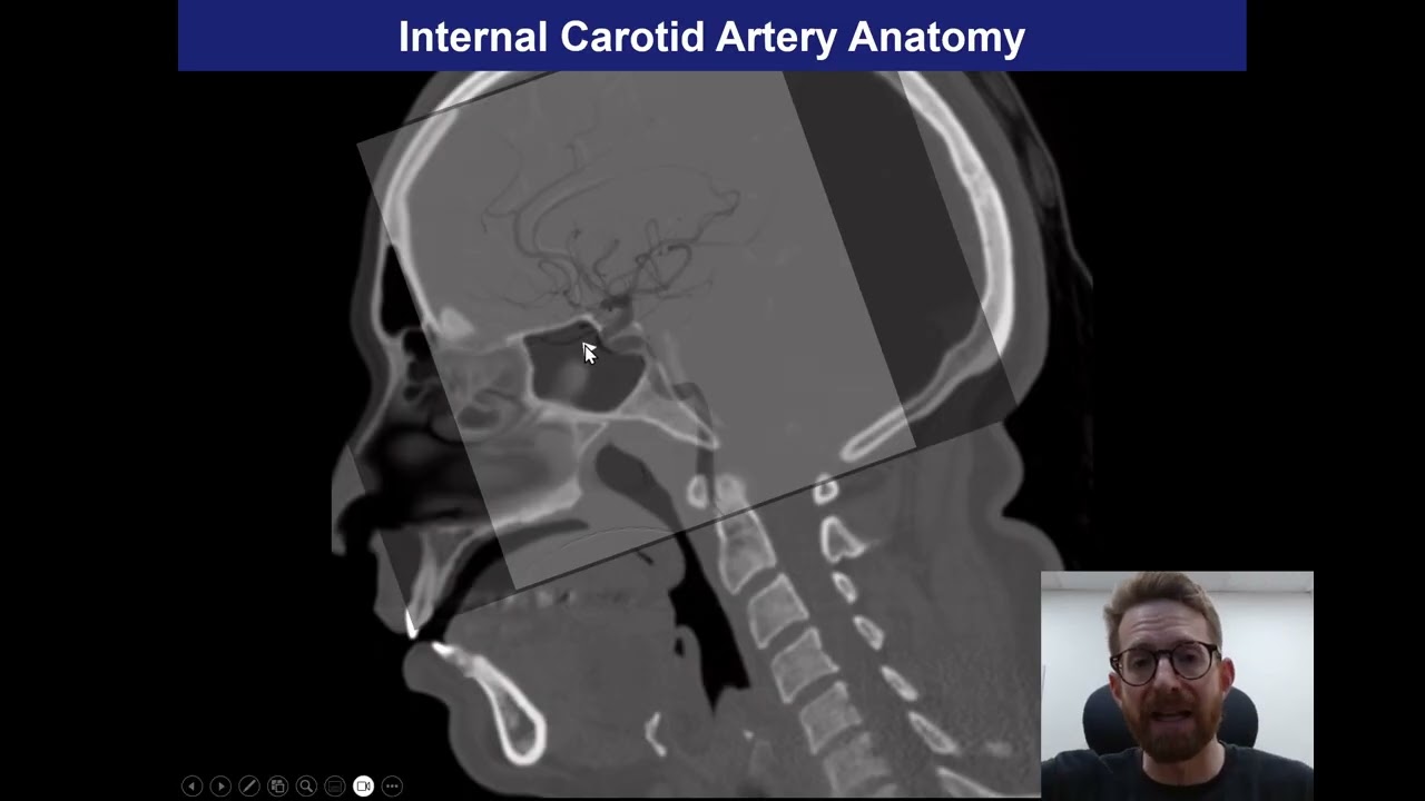 Anatomy of the Sellar and Parasellar Regions