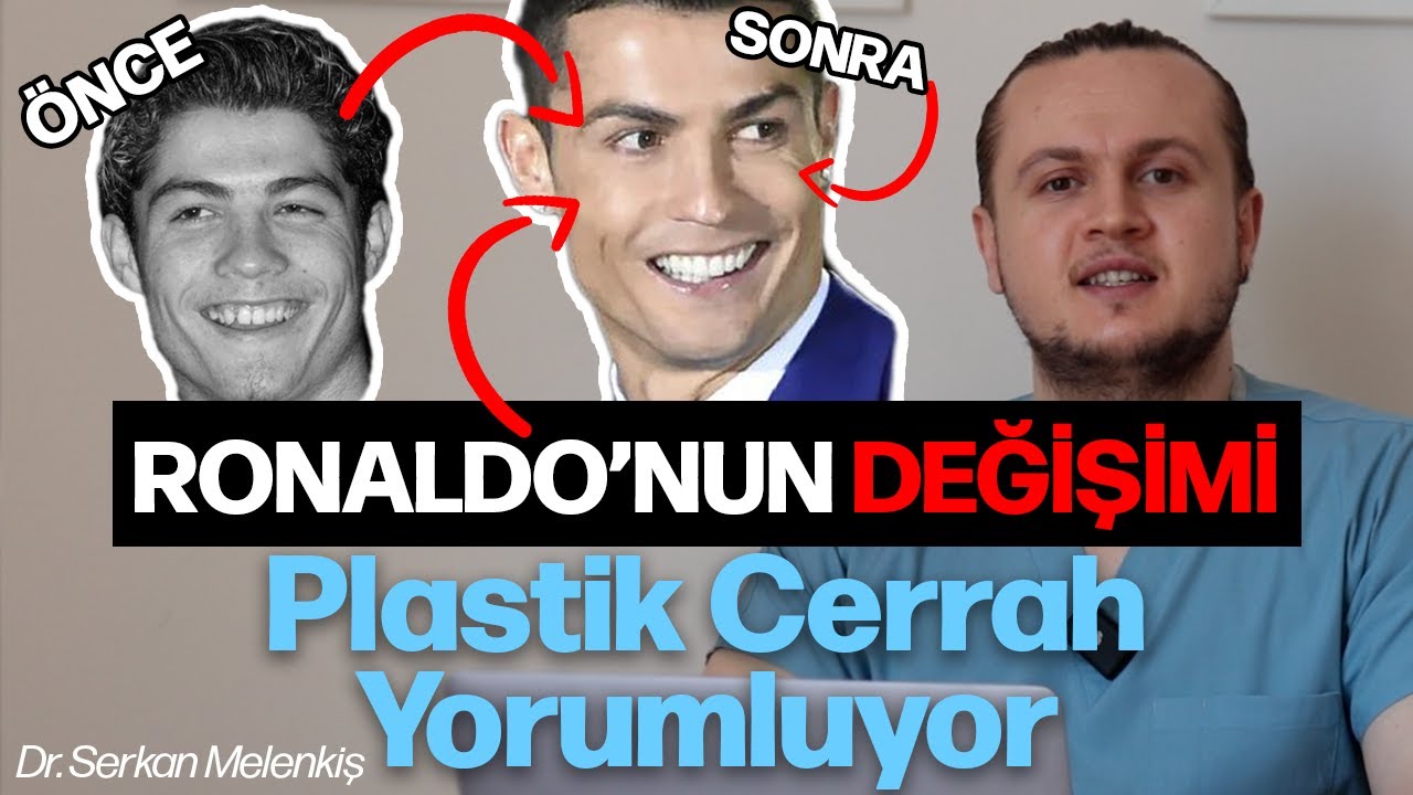 Cristiano Ronaldo&rsquo;nun Estetik Değişimi | Plastik Cerrah G&ouml;z&uuml;yle Analiz