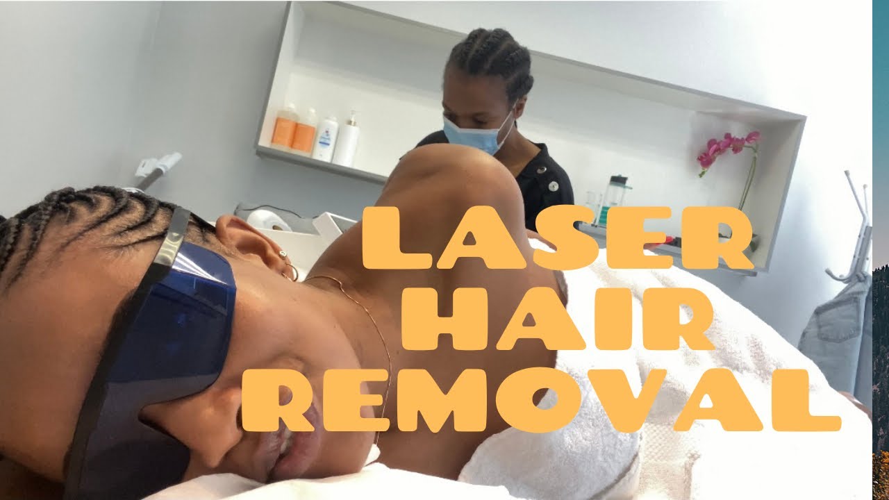 LASER HAIR REMOVAL DAY!!!! VLOG!!!