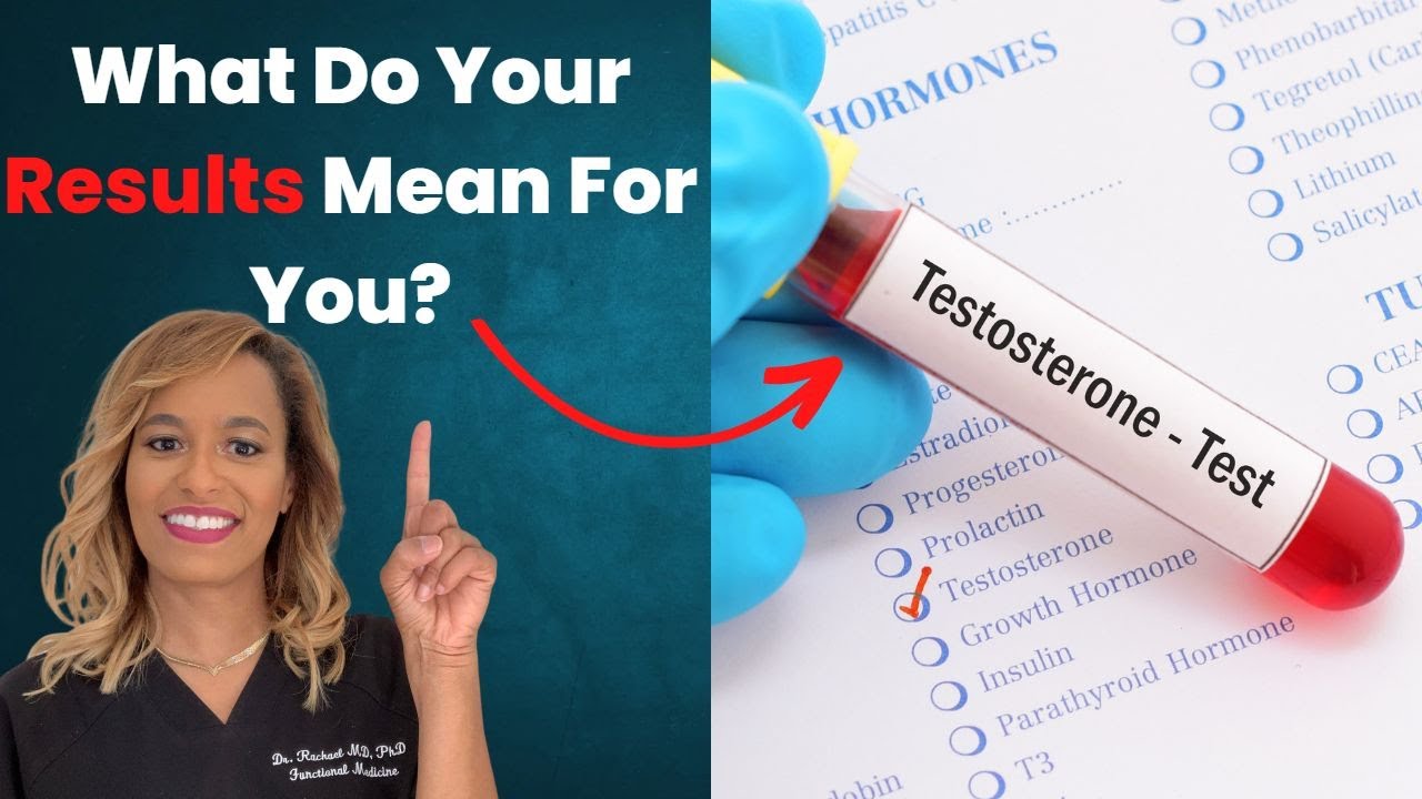 Unlock the Secrets of Your Testosterone Lab Results