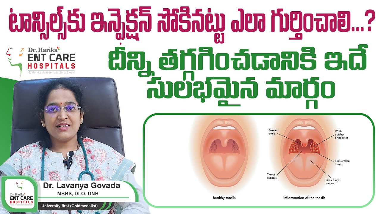 టాన్సిల్స్‌ ఎలా గుర్తించాలి...?  || Tonsillitis - Symptoms, Causes || Dr Harika ENT Care Hospital
