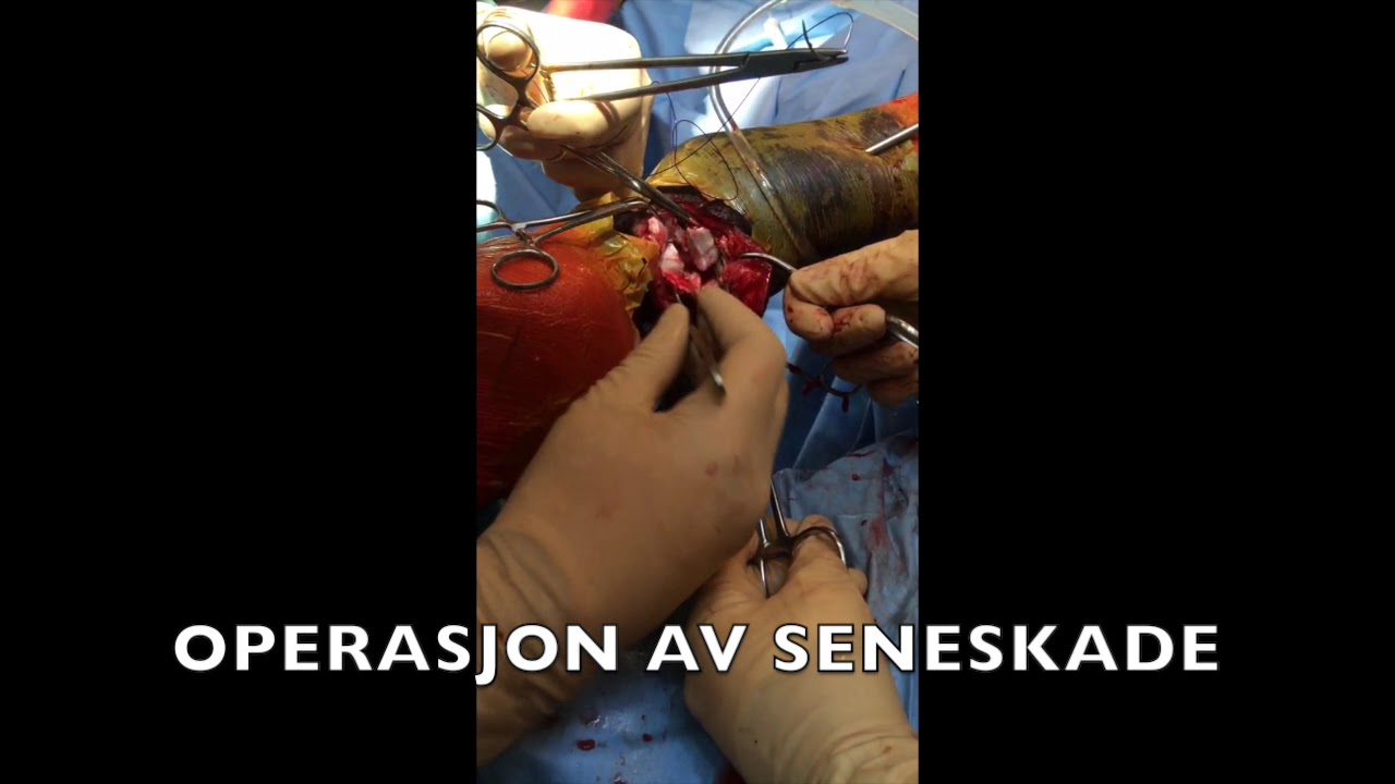 SENESKADE